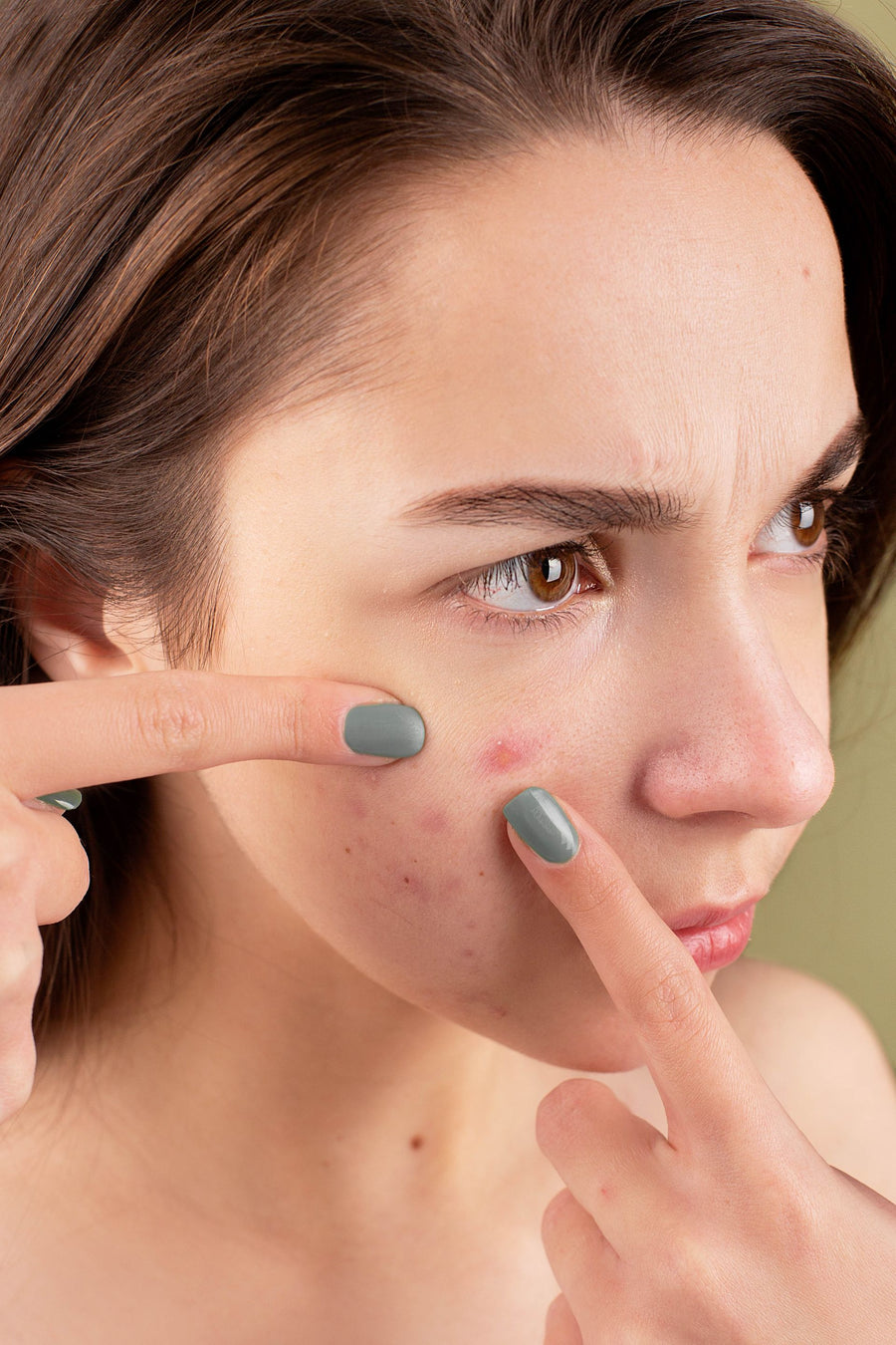 Young adult looking at their skin in a mirror while considering acne treatment options